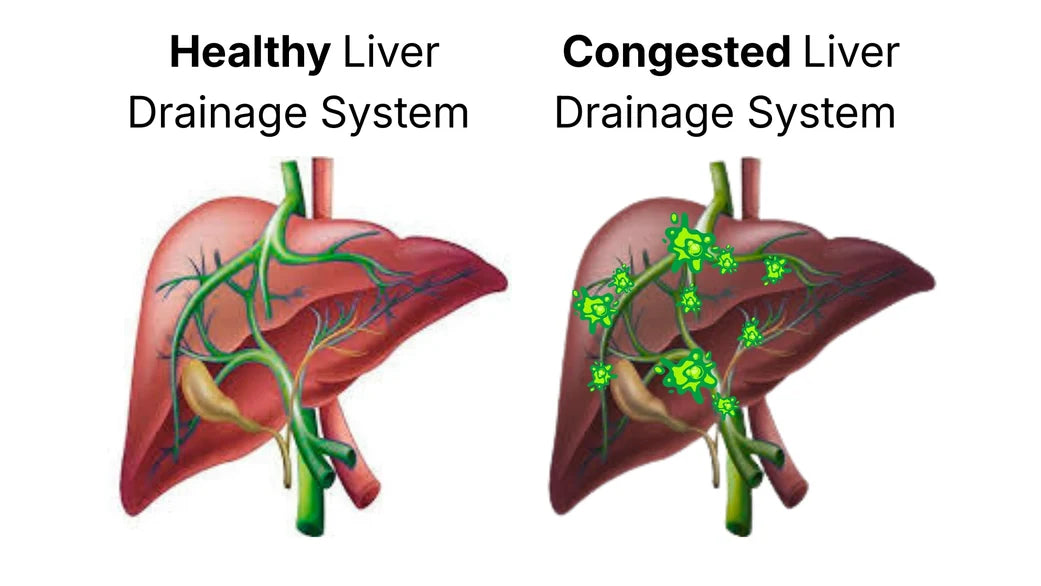 Healthy and congested liver drainage comparison
